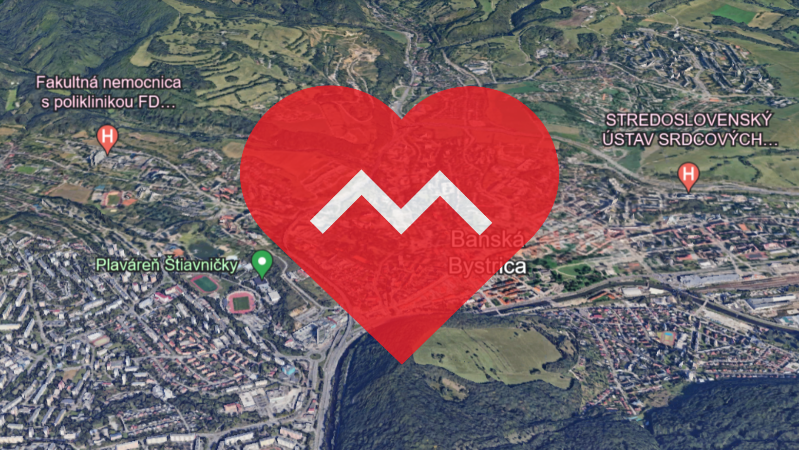 Prečo METRONET?